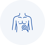 Hernias de Pared Abdominal - Dr. Mario Padrón Ricardo